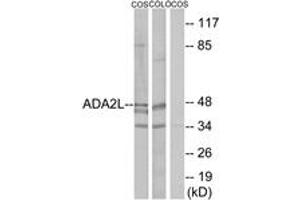 Western Blotting (WB) image for anti-Transcriptional Adaptor 2A (TADA2A) (AA 206-255) antibody (ABIN2889346) (TADA2L Antikörper  (AA 206-255))