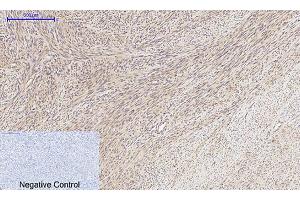 Immunohistochemical analysis of paraffin-embedded human uterus tissue. (MMP2 Antikörper  (AA 580-660))