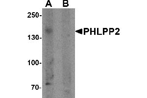 Western blot analysis of PHLPP2 in SW480 cell lysate with PHLPP2 antibody at 1 µg/mL in (A) the presence and (B) the absence of blocking peptide. (PHLPP2 Antikörper  (C-Term))