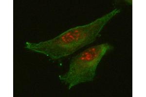 IF analysis of RETREG1 using anti-RETREG1 antibody (ABIN7599962) and anti-Tubulin Alpha antibody (ABIN7600339). (FAM134B Antikörper  (AA 131-446))
