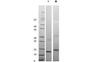 SDS-PAGE of Human Tumor Necrosis Factor Receptor Type 1 Recombinant Protein SDS-PAGE of Human Tumor Necrosis Factor Receptor Type 1 Recombinant Protein. (TNFRSF1A Protein)