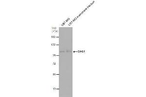 WB Image DAG1 antibody detects DAG1 protein by western blot analysis. (Dystroglycan Antikörper)
