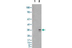HEK293 overexpressing SIRT4 and probed with SIRT4 polyclonal antibody  (mock transfection in first lane), tested by Origene. (SIRT4 Antikörper  (C-Term))