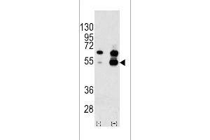 Western blot analysis of VEGF1 Antibody polyclonal antibody using 293 cell lysates (2 ug/lane) either nontransfected (Lane 1) or transiently transfected with the VEGF1 gene (Lane 2).