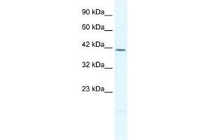 WB Suggested Anti-PITX2 Antibody Titration:  2. (PITX2 Antikörper  (N-Term))