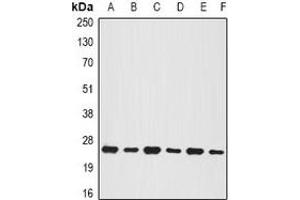 Western blot analysis of BNIP1 expression in MCF7 (A), Jurkat (B), mouse testis (C), mouse pancreas (D), rat brain (E), rat liver (F) whole cell lysates. (BNIP1 Antikörper)