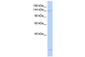 SMC4 antibody used at 1 ug/ml to detect target protein. (SMC4 Antikörper  (N-Term))