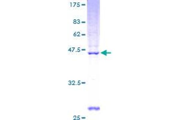 PNOC Protein (AA 1-176) (GST tag)