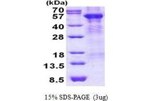 SDS-PAGE (SDS) image for Arylsulfatase A (ARSA) (AA 21-509) protein (His tag) (ABIN5852963) (Arylsulfatase A Protein (ARSA) (AA 21-509) (His tag))