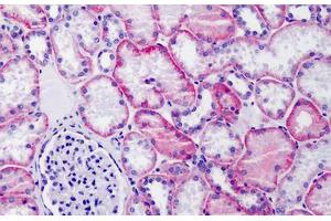 Human Kidney: Formalin-Fixed, Paraffin-Embedded (FFPE) (CD147 Antikörper  (N-Term))