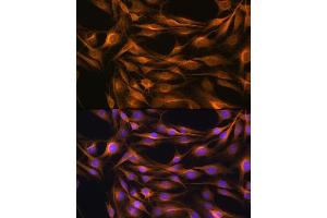 Immunofluorescence analysis of C6 cells using SO Rabbit pAb (ABIN6129624, ABIN6148259, ABIN6148260 and ABIN6221917) at dilution of 1:100. (SOAT1 Antikörper  (AA 1-130))