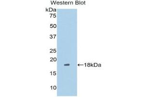 Western Blotting (WB) image for anti-Leucine Rich Repeat (In FLII) Interacting Protein 1 (LRRFIP1) (AA 128-250) antibody (ABIN1859714) (LRRFIP1 Antikörper  (AA 128-250))