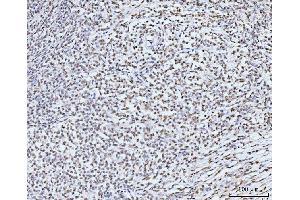 IHC analysis of KIFC1 using anti-KIFC1 antibody (ABIN7599523). (KIFC1 Antikörper  (AA 1-673))
