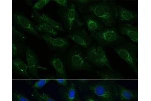 Immunofluorescence analysis of U-2 OS cells using NDUFB4 Polyclonal Antibody at dilution of 1:100 (40x lens). (NDUFB4 Antikörper)