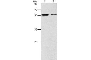 Western Blot analysis of Jurkat and 293T cell using ARHGAP15 Polyclonal Antibody at dilution of 1:500 (ARHGAP15 Antikörper)