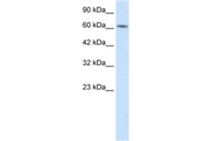 Western Blotting (WB) image for anti-Kelch-Like 28 (KLHL28) antibody (ABIN2460991)