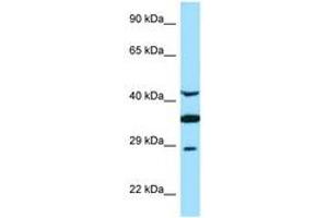 Image no. 1 for anti-Torsin Family 1, Member A (Torsin A) (TOR1A) (AA 201-250) antibody (ABIN6748405) (TOR1A Antikörper  (AA 201-250))