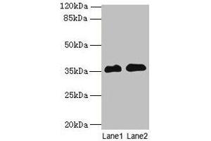 Western blot All lanes: RFPL3 antibody at 8 μg/mL Lane 1: Human placenta tissue Lane 2: HL60 whole cell lysate Secondary Goat polyclonal to rabbit IgG at 1/10000 dilution Predicted band size: 36, 33 kDa Observed band size: 36 kDa (RFPL3 Antikörper  (AA 8-288))