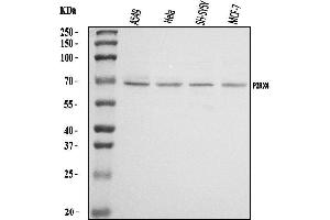 Western blot analysis of P2X4/P2RX4 using anti-P2X4/P2RX4 antibody (ABIN7599737).