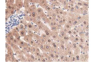 Immunohistochemical staining of paraffin-embedded Human liver tissue using anti-PRPSAP2 mouse monoclonal antibody. (PRPSAP2 Antikörper)