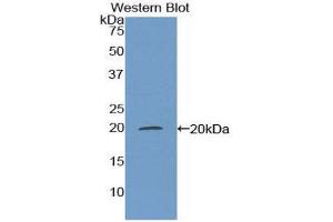 Western Blotting (WB) image for anti-Matrix Gla Protein (MGP) (AA 20-104) antibody (ABIN1174663)