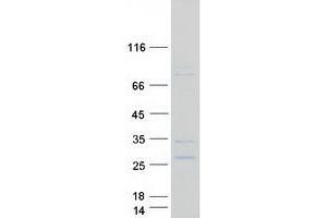 BPI Fold Containing Family A, Member 3 (BPIFA3) (Transcript Variant 2) protein (Myc-DYKDDDDK Tag)