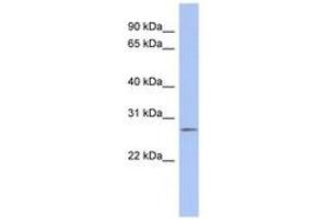 Image no. 1 for anti-Chromosome 14 Open Reading Frame 166 (C14orf166) (C-Term) antibody (ABIN6742486)
