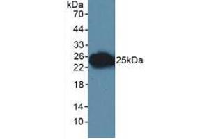 Western blot analysis of Human Lymphocyte Cells. (F11R Antikörper  (AA 64-249))