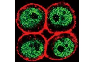 Immunofluorescence (IF) image for anti-Proliferating Cell Nuclear Antigen (PCNA) (AA 89-117) antibody (ABIN389345)
