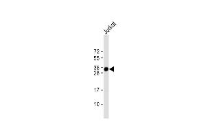 Anti-TMX1 Antibody (C-term) at 1:1000 dilution + Jurkat whole cell lysate Lysates/proteins at 20 μg per lane. (TMX1 Antikörper  (C-Term))