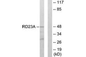 Western blot analysis of extracts from LOVO cells, using RAD23A Antibody. (RAD23A Antikörper  (AA 91-140))