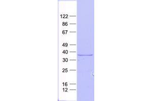 Validation with Western Blot (ATP Synthase Subunit gamma (AtpC) protein (His tag))