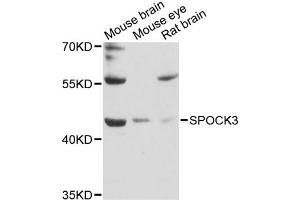 Western blot analysis of extracts of various cell lines, using SPOCK3 antibody (ABIN6292517) at 1:3000 dilution.