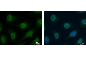 ICC/IF Image TrxR1 antibody detects TrxR1 protein at cytoplasm and nucleus by immunofluorescent analysis. (TXNRD1 Antikörper)