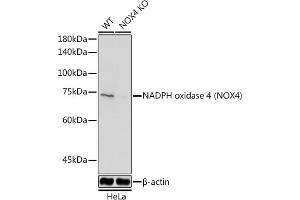 Western blot analysis of extracts from normal (control) and NADPH oxidase 4 (NOX4) Rabbit pAb knockout (KO) HeLa cells, using NADPH oxidase 4 (NOX4) Rabbit pAb antibody (ABIN6128328, ABIN6144752, ABIN6144753 and ABIN6215143) at 1:1000 dilution. (NADPH Oxidase 4 Antikörper  (AA 328-578))