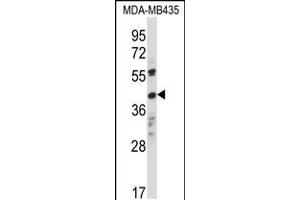 Western blot analysis in MDA-MB435 cell line lysates (35ug/lane). (OR8K1 Antikörper  (C-Term))