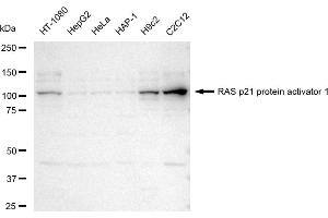 Western blotting analysis using RAS p21 protein activator 1 antibody (ABIN7800111). (Rekombinanter RACGAP1 Antikörper)