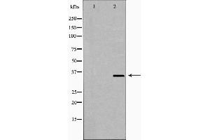 Western blot analysis of extracts of Jurkat using NUDT6 Antibody.