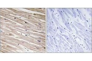 Immunohistochemistry analysis of paraffin-embedded human heart, using PEA-15 (Phospho-Ser104) Antibody. (PEA15 Antikörper  (pSer104))