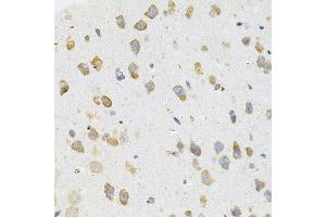 Immunohistochemistry of paraffin-embedded mouse brain using TGM2 antibody. (Transglutaminase 2 Antikörper)