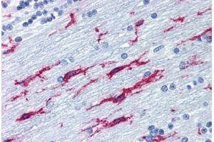 Human Brain, Cerebellum (formalin-fixed, paraffin-embedded) stained with ITGB2 antibody ABIN298664 at 10 ug/ml followed by biotinylated anti-mouse IgG secondary antibody ABIN481714, alkaline phosphatase-streptavidin and chromogen. (Integrin beta 2 Antikörper)
