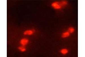 ABIN6267568 staining HeLa cells by ICC/IF.
