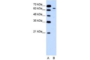 KRT2A antibody used at 0. (Keratin 2 Antikörper  (Middle Region))