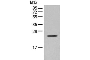 Western blot analysis of Human placenta tissue lysate using CARD16 Polyclonal Antibody at dilution of 1:800 (CARD16 Antikörper)
