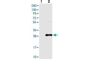 Western blot analysis of Lane 1: Negative control (vector only transfected HEK293T lysate), Lane 2: Over-expression Lysate (Co-expressed with a C-terminal myc-DDK tag (~3. (PCNP Antikörper)
