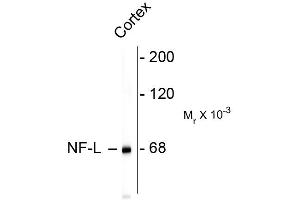 Western blots of rat cortex lysate showing specific immunolableing of the ~ 68k NF-L protein. (NEFL Antikörper)