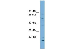 WB Suggested Anti-CYP2R1 Antibody Titration:  0. (CYP2R1 Antikörper  (Middle Region))