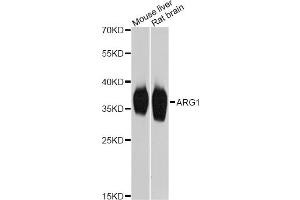 Western blot analysis of extracts of various cell lines, using ARG1 Antibody (ABIN1875417) at 1:2000 dilution. (Liver Arginase Antikörper)
