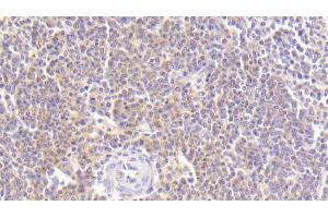 Detection of MDC in Human Spleen Tissue using Polyclonal Antibody to Macrophage Derived Chemokine (MDC) (CCL22 Antikörper  (AA 25-93))