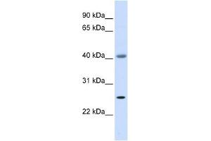 ADA antibody used at 1 ug/ml to detect target protein. (ADA Antikörper  (Middle Region))